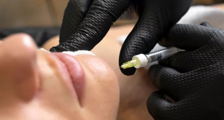 تزریق آنزیم تخلیه ژل