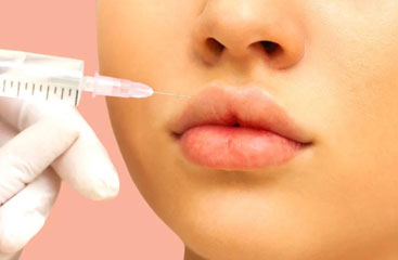 انواع مدل های تزریق ژل لب
